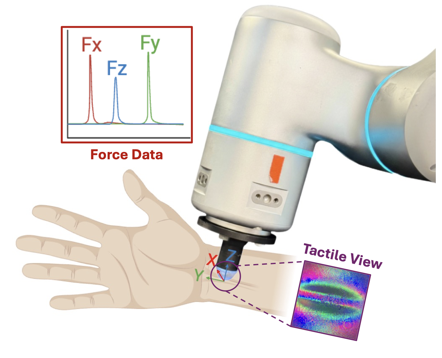 PVFT multimodal palpation sensor with CoinFT